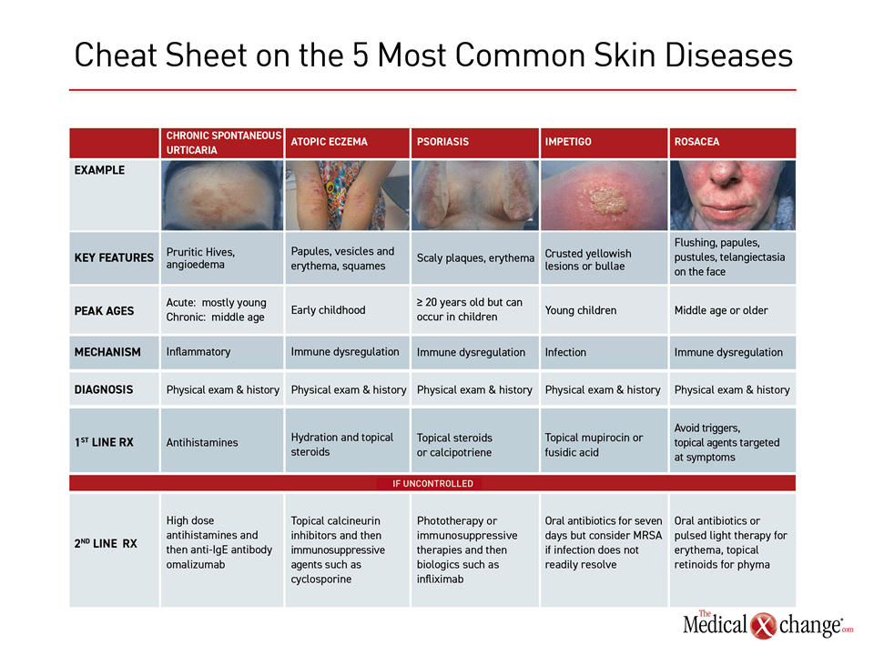 skin disease thesis topics